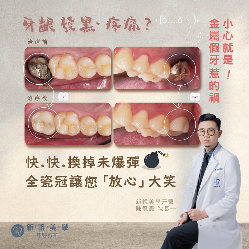 新悅美學牙醫診所的案例分享圖片